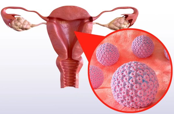 Tầm soát virus HPV ung thư cổ tử cung