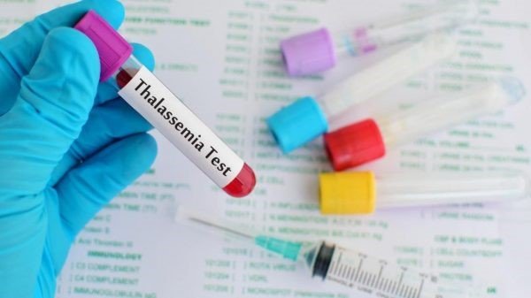Bệnh tan máu bẩm sinh Thalassemia