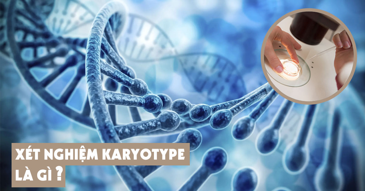 Xét nghiệm Karyotype