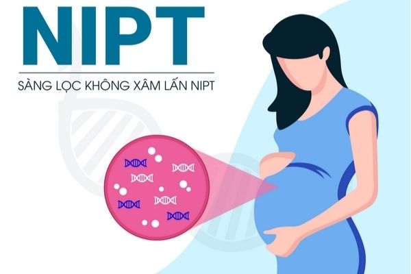 Nên làm xét nghiệm NIPT để tốt cho cả trẻ và mẹ bầu