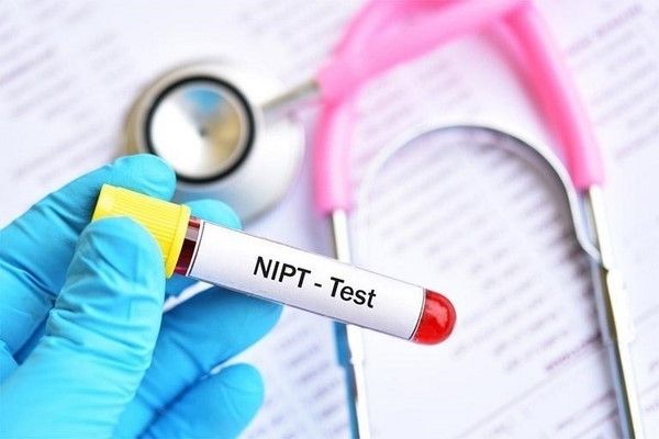 Xét nghiệm NIPT rất an toàn và chính xác