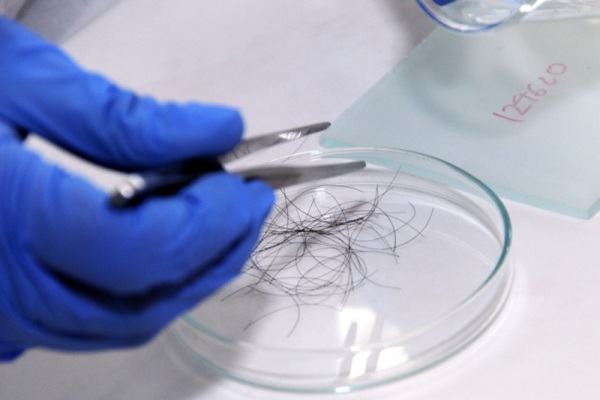 xét nghiệm ADN bằng tóc