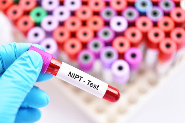 gói xét nghiệm NIPT