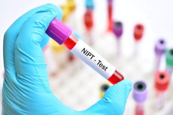 Gói xét nghiệm NIPT
