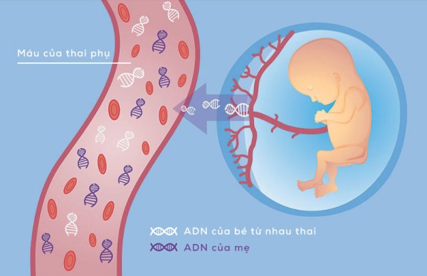 ADN thai nhi có trong máu của mẹ