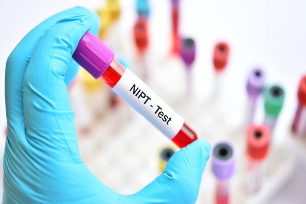 xét nghiệm NIPT cần bao nhiêu máu
