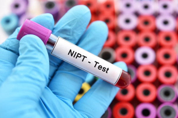 xét nghiệm sàng lọc NIPT chính xác không