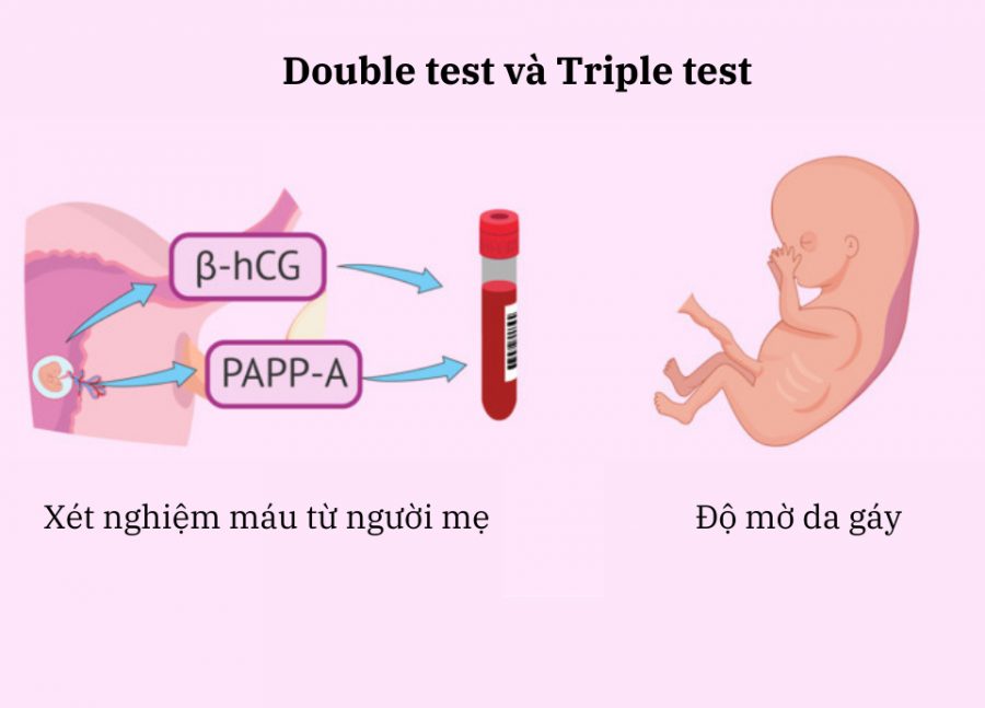 Double Test khảo sát định lượng 2 chất trong máu mẹ & đo độ mờ da gáy