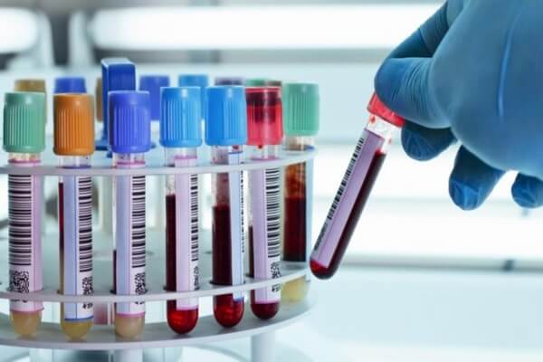 Mẫu máu được sử dụng trong quá trình xét nghiệm không xâm lấn