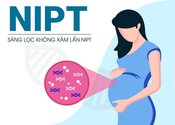 Xét nghiệm không xâm lấn NIPT chính là dựa trên DNA của thai nhi
