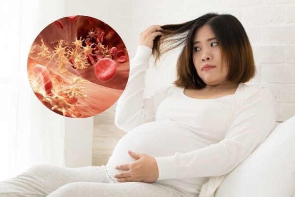 Hội chứng tăng đông Thrombophilia gây nguy hiểm cho thai phụ