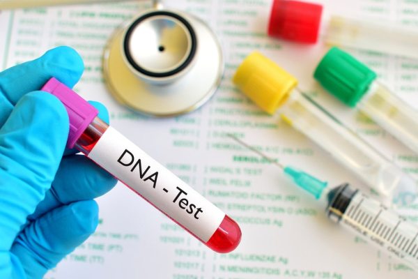 Xét nghiệm ADN thai nhi xác định quan hệ huyết thống cha con