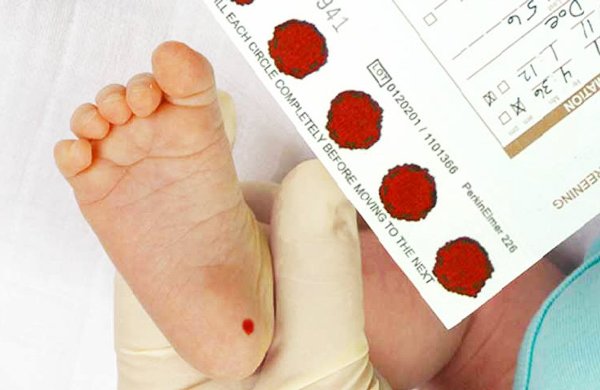 Xét nghiệm máu sàng lọc sơ sinh