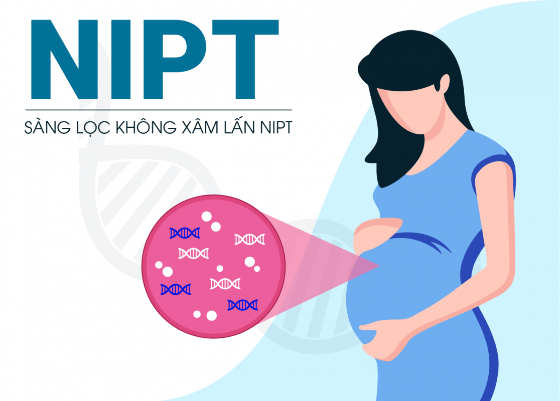 Thực hiện xét nghiệm NIPT rồi có cần chọc ối không?