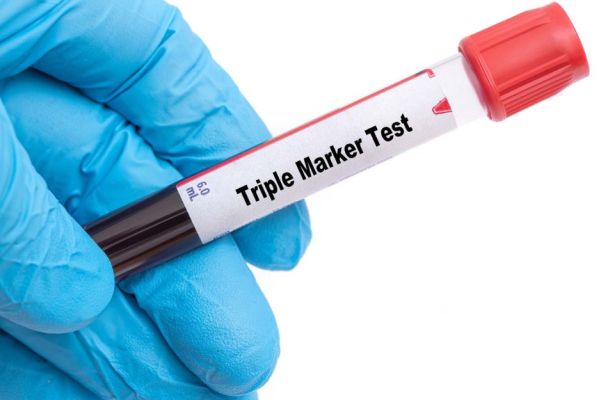 Lấy máu làm xét nghiệm Triple Test