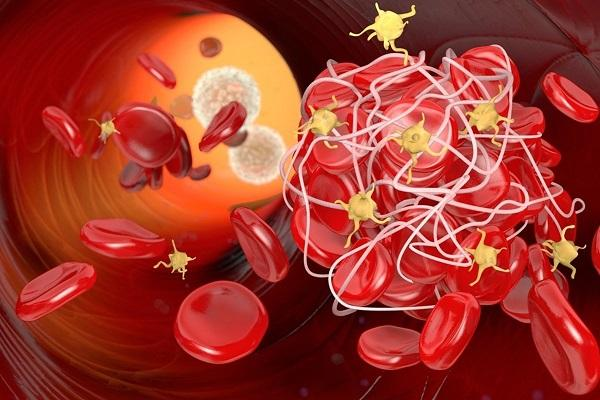 Thrombophilia là bệnh gì?